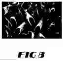 Fig. 07 - Implantable textile prostheses having PTFE cold drawn yarns