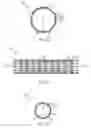 Fig. 05 - Positional locking endoluminal device system