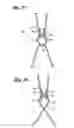 Fig. 08 - Implantable vascular graft