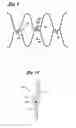 Fig. 09 - Implantable vascular graft