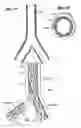 Fig. 16 - Implantable vascular graft