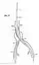 Fig. 22 - Implantable vascular graft
