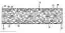 Fig. 01 - Drug-eluting stent cover method of use