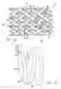 Fig. 03 - Drug-eluting stent cover method of use