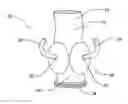 Fig. 01 - Vascular prosthesis