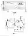 Fig. 06 - Vascular prosthesis