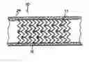 Fig. 01 - Degradable medical device