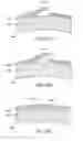 Fig. 18 - Method for increasing the depth of focus of a patient