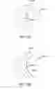 Fig. 30 - Method for increasing the depth of focus of a patient