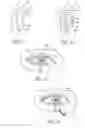 Fig. 08 - Masked intraocular devices