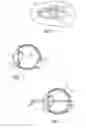 Fig. 02 - Mask configured to maintain nutrient transport without producing visible diffraction patterns