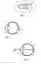 Fig. 02 - Mask configured to maintain nutrient transport without producing visible diffraction patterns