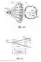 Fig. 12 - Method of making an ocular implant
