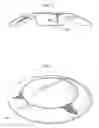 Fig. 03 - Multilens intraocular lens system with injectable accommodation material