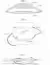 Fig. 04 - Multilens intraocular lens system with injectable accommodation material