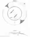 Fig. 05 - Multilens intraocular lens system with injectable accommodation material