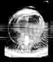 Fig. 10 - Multilens intraocular lens system with injectable accommodation material