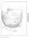 Fig. 11 - Multilens intraocular lens system with injectable accommodation material