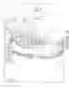 Fig. 12 - Multilens intraocular lens system with injectable accommodation material
