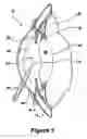 Fig. 02 - Apparatus and methods for isolating lens capsule fluids