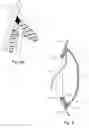 Fig. 06 - Apparatus and methods for isolating lens capsule fluids