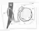 Fig. 01 - Retinal prosthesis with side mounted inductive coil