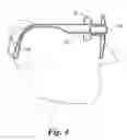 Fig. 05 - Retinal prosthesis with side mounted inductive coil