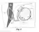 Fig. 07 - Retinal prosthesis with side mounted inductive coil
