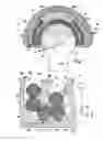 Fig. 02 - Hip prosthesis and the use thereof