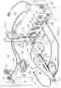 Fig. 03 - System for controlling a flow of fluid through a rotational atherectomy device