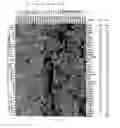 Fig. 07 - Method of diagnosis of cancer based on gene expression profiles in cells