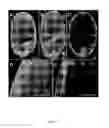 Fig. 11 - Transgenic rice line producing high level of flavonoids in the endosperm