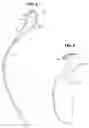 Fig. 03 - Shower curtain holder