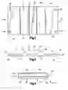 Fig. 03 - Cardiopulmonary assist device