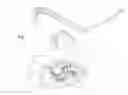 Fig. 02 - Rotating brush attachment for use with a vacuum