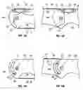 Fig. 08 - Blade actuating stop