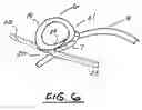 Fig. 06 - Plant protection system