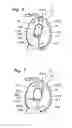 Fig. 07 - Fluid coupling