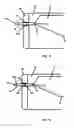Fig. 08 - Suspension setting for gemstones