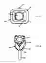 Fig. 10 - Suspension setting for gemstones