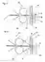 Fig. 03 - Knitted fabric, method and device for producing said fabric