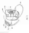 Fig. 17 - Dual locking device