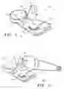 Fig. 02 - Tire pressure sensor assembly
