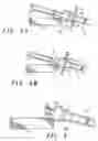 Fig. 04 - Tire pressure sensor assembly