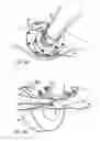 Fig. 04 - Apparatus and method for reducing vibration