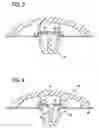 Fig. 03 - Mounting structure of resin molded part
