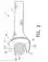 Fig. 03 - Spanner with teeth section at clamp portion
