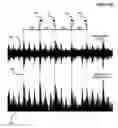 Fig. 03 - Evaluating and correcting rhythm in audio data