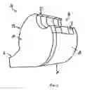 Fig. 03 - Whistle