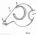 Fig. 06 - Whistle